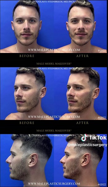 mensplasticsurgery on TikTok
