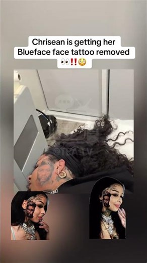 Chrisean crying during her laser tattoo removal of blueface