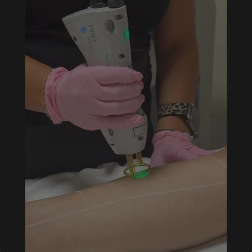 ✨ Smooth. Effortless. Undeniably feminine. Shaving? Waxing? Ingrowns? That’s not luxury. That’s work. Hidden Hills Medspa is bringing you the only laser hair removal offer you’ll ever need: ⚡ FULL BODY Single Session — just $299 ⚡ 1 YEAR UNLIMITED FULL BODY — only $1900 Your smoothest, most effortless year starts now. FULL BODY means FULL BODY: ✅ Full legs ✅ Brazilian ✅ Navel ✅ Back ✅ Full arms ✅ Arm pits This isn’t just about hair removal. It’s about stepping into your most confident, feminine 