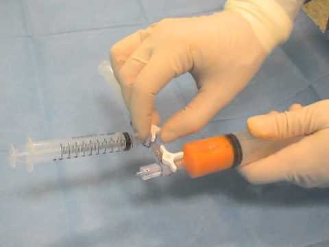 A Simple Device for Syringe-to-Syringe Transfer During Lipofilling