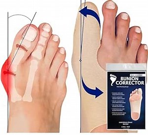 Bunion Bootie Bunion Corrector for Men Big Toe Straightener Splint for Bunion Relief, Bunions Correction Men Big Toe Brace, Bunion Socks for Men Bunion Shoes (Large, Right), beige