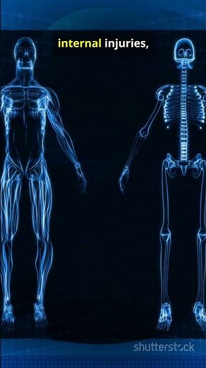 X-ray vs CT Scan vs MRI – Know the Difference!