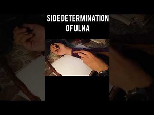 Upper Limb Osteology: Side Determination of All Bones (MBBS / BDS)