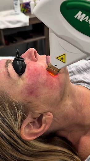 28 reactions · 6 comments | IPL Photofacial Benefits ✨ Say goodbye...