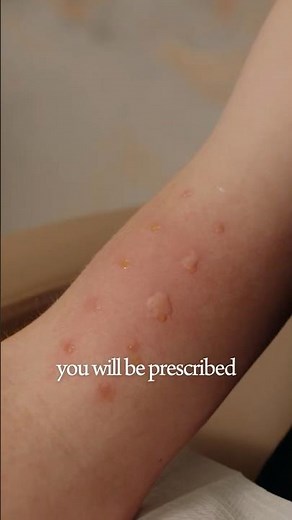 How Allergy Tests Work: A Step-by-Step Overview