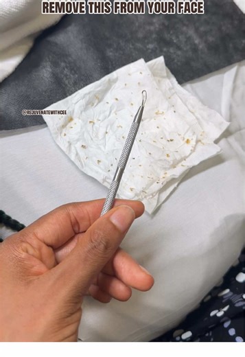 I know you’ve seen those videos where someone is using oil cleanser to remove this from their face,it’s not real. A good old extraction done by an aesthetician will always give you better results. If your face has never been smooth,it’s always bumpy,it’s time to book a facial with me,booking link is on my bio. #rejuvenatewithcee