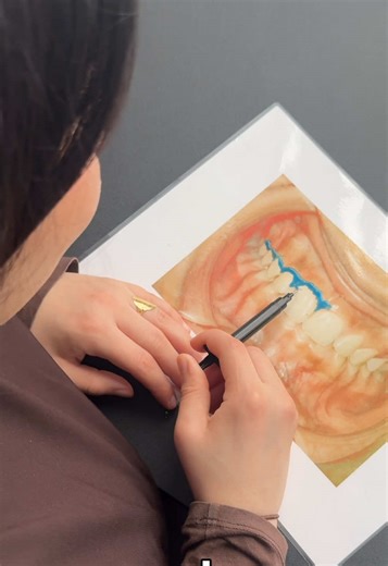 Formation blanchiment dentaire chez Full Beauty ✨ Une formation complète avec théorie et pratique pour apprendre la prestation dans de bonnes conditions. Produits, fournisseurs, contre-indications, protocole… tout est expliqué pour repartir avec les bonnes bases. Une prestation qui peut être rapidement rentabilisée en institut. 💳 Paiement possible en plusieurs fois. 📩 Infos et inscriptions en message privé.