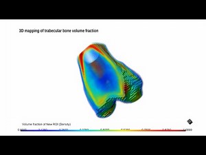 Creating Vector Fields & Volume Fraction with the Bone Analysis tool of Dragonfly.