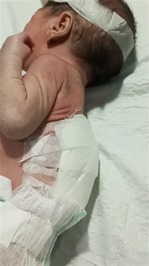 MMC Newborn Baby Shrill Cry | Emotional Moment in NICU 👶💔 #cute #baby #babypics #babyboy