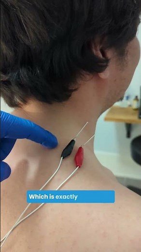 How Electro Acupuncture Actually Helps You Heal ⚡️