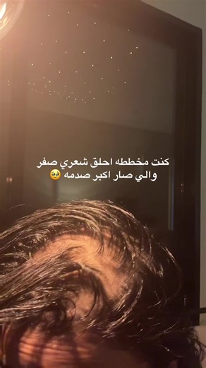 بنات تكفون قولوا ماشاءالله والله تعبت على نتيجتي سنه كاملهه كلها عنايه لين شفت شعري كثيف اخيرا😢#صلع_وراثي #اكسبلور