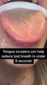 Tongue Cleaner #Dentistry #LearningTips #BitesnBraces #smile #medical #People #dentista #Tooth #Implant #Dental #dentist | Bites & Braces Dental