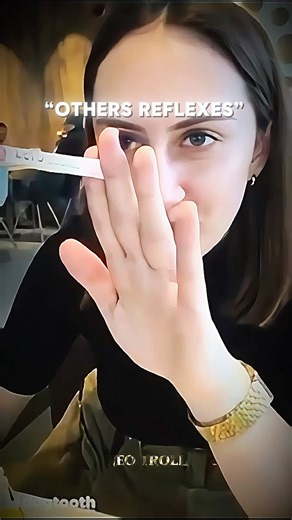 Normal Reflexes Vs King Of Reflexs