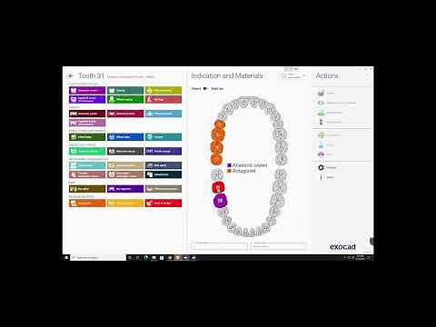 Importing an Atlantis Core File into Exocad