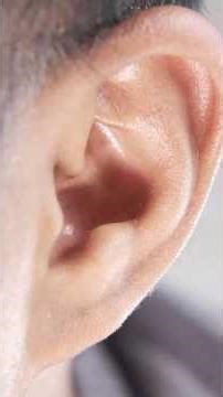 Tinnitus Explained: Why Your Ears Ring #tinnitus