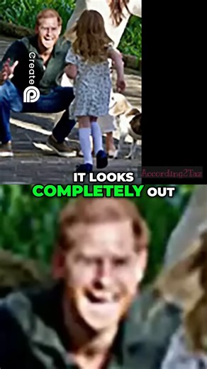 100K views · 384 reactions | Club Foot Explained: What The Photograph Reveals! #christmas #holidayfun #challenge #contest #dailychallenge | According 2taz | Facebook