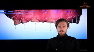 9.9K views · 239 reactions | VERTICAL OCCLUSAL DIMENSION WITH HOLISTIC APPROACH This is a mini webinar (33 min)... which is shortcut of a full webinar (1:33 h )... that was a shortcut of the VOD lectures from the course (3-4 h)  I hope you will enjoy that condensed knowledge ! See you around soon ! Lukas www.master-level.pl/en | Lukas Lassmann The Dentist | Facebook