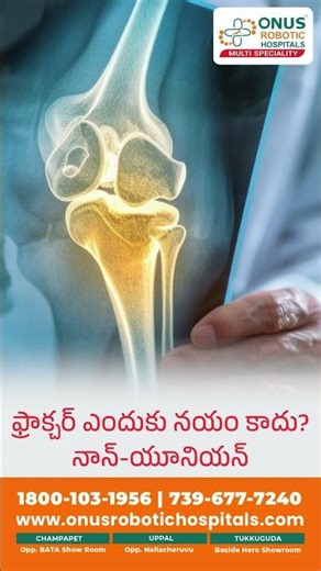 If a fracture doesn’t heal on time, it’s not bad luck — it’s called non-union.mp4