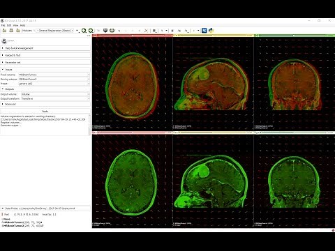 Elastix registration toolbox in 3D Slicer