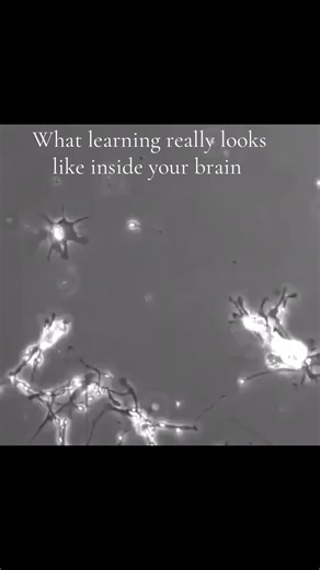 Understanding Neuroplasticity: The Science of Learning