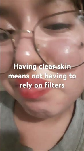 Took many years to achieve but worth it #skincare #skinbrightening