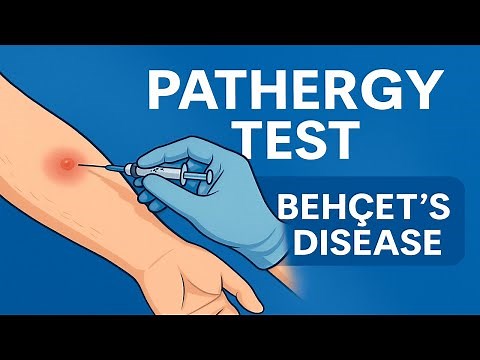 Pathergy Test for Behçet’s Disease | Procedure & Clinical Importance