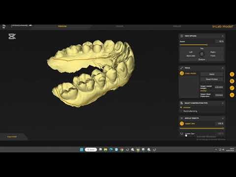 How to make and print models with inLab and PrimePrint