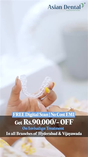 Missed the Invisalign Open Day earlier? The good news is, the offer is now extended till 31st December, so you still have a chance to start clear aligner treatment with massive savings. Get Rs.90,000/- OFF on Invisalign, along with a FREE digital scan and convenient No Cost EMI options across all Asian Dental branches in Hyderabad and Vijayawada, so you can begin your smile transformation without worrying about the budget. This post highlights how Invisalign lets you straighten your teeth discre
