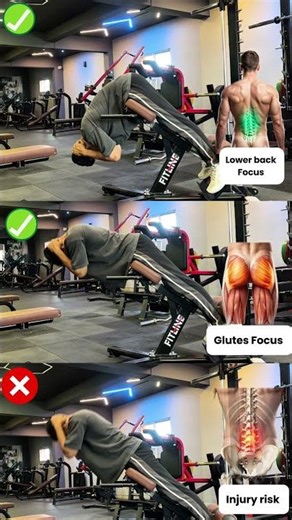 Don’t Destroy Your Spine Doing This ❌ Back Extension Fix