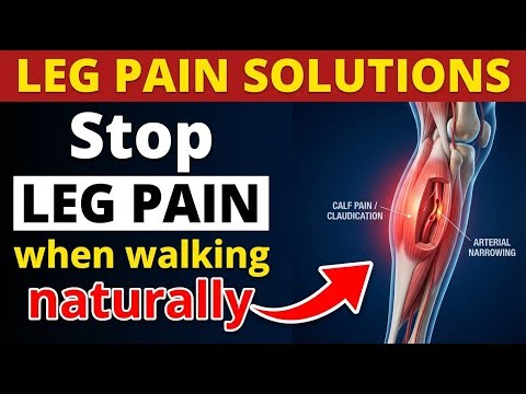 Leg Pain When Walking The Natural Bypass Fix Claudication