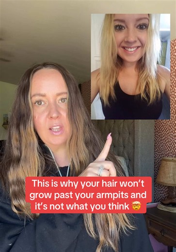 If your hair won’t grow past a certain length, breaks easily, or seems thinner than it used to, nutritional gaps could be part of the story. Hair follicles need key nutrients to support healthy growth, strength, and shine. That’s why I love adding a hair gummy packed with beauty-supporting vitamins to my routine. Healthy hair starts from within, and consistency matters more than quick fixes. Your future hair is being built by what you do today. Start now so you don’t hate your hair anymore, the 