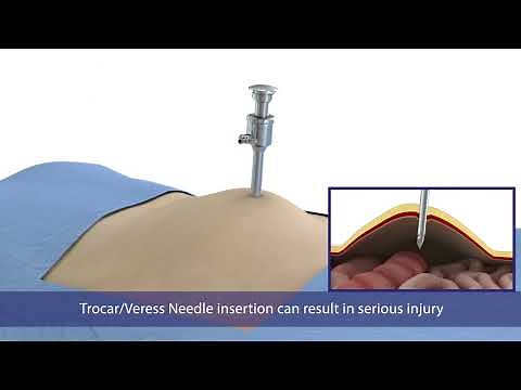 Introduction to Laparoscopy Surgery