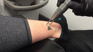 387K views · 348 reactions | Send a picture of your tattoo in a private message to receive a free price quote. You can also set up a free in person consultation by calling 724-972-7734 or visiting www.disappearinginkltr.com | Disappearing Ink, Laser Tattoo Removal | Facebook
