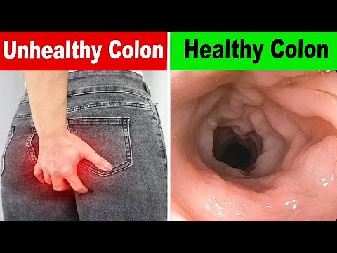 12 Effective Ways You Can Make Your Colon Healthy