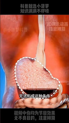 Why Coke & Mentos Makes A Terrible Science Experiment