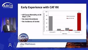 Powered Aspiration Thrombectomy for STEMI and Beyond