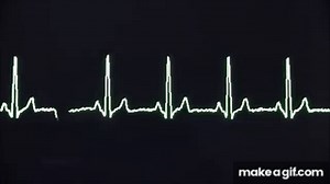 Cardiac arrest rhythms, VF, VT, Asystole and PEA on Make a GIF