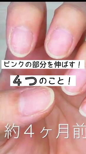 ハイポニキウムを育成して爪のピンクの部分を伸ばすためにやった4つのこと！ 1.爪切りを使わずにヤスリで整える 2.保湿する 3.爪を保護する 4.爪の使い方に気をつける 少し前の動画になりますが、 YouTubeで詳しくご覧頂けます。 プロフィールのリンクからご覧ください😊 @nail_life.34 YouTubeでは100均アイテムを使ったセルフジェルネイルなど、他にも色々ご覧頂けます✨ 良かったらぜひのぞいて見て下さい😌 #爪のピンクの部分を伸ばしたい #ハイポニキウム #ハイポニキウム育成 #育爪 #セルフネイル #セルフネイルケア #女子力アップ #自分磨き #美爪 #美爪育成