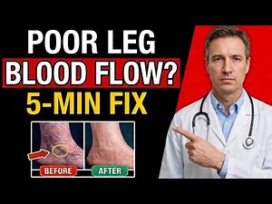 Poor Leg Circulation? 30-Second Test + 3 Fast Fix