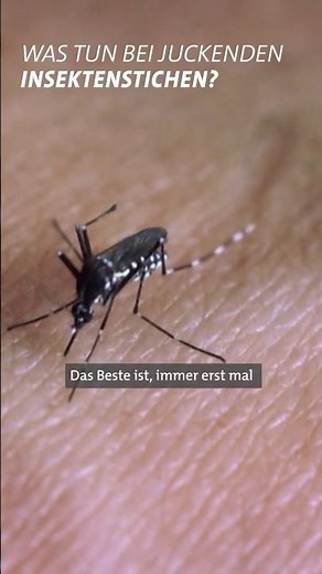 Mücken, Wespen, Bienen: Die besten Hausmittel bei Insektenstichen 🐝😫 | Marktcheck SWR #shorts