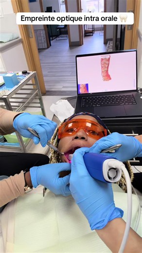 Empreinte optique intraorale: comment ça marche chez Clinique DENTAL ZEN