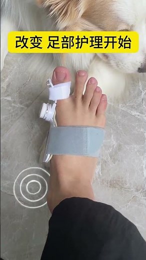 Adjustable Bunion Corrector for Toe Alignment and Daily Foot Comfort Care