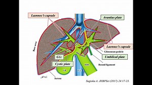 Standardization of Anatomic Liver Resection Based on Laennec's Capsule
