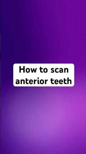 Scan anterior teeth and occlusal surfaces | iTero™ intraoral scanner