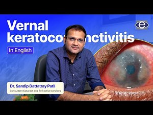 Understanding Vernal Keratoconjunctivitis | Keratoconus Treatment | #VernalKeratoconjunctivitis