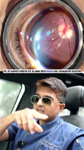 What Is Indirect Ophthalmoscopy? | How Doctors Examine Your Retina & Optic Nerve