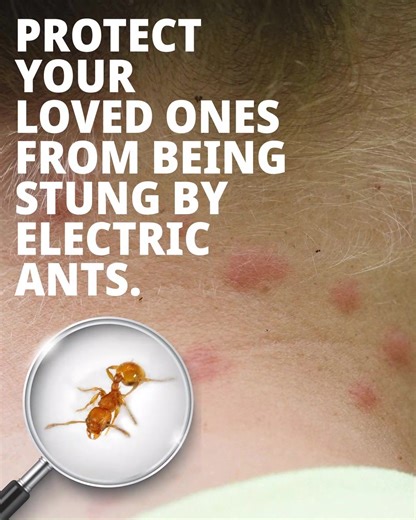 Electric ant fast facts! 🐜⚡ Electric ants can permanently blind pets, kill and displace native wildlife and pose a serious threat to our environment, agriculture, industry and ecosystem. Electric ants are also different to other invasive species – so the bait treatment and the way it is used is different. The protein-based granular bait used specifically for electric ants is harmless to humans and animals. It is only spread on infested properties including a 50m buffer zone. It is non-residual,
