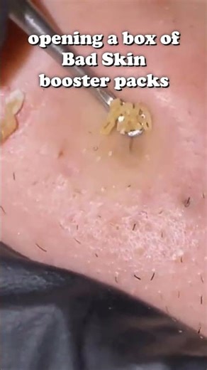 opening a box of bad skin booster packs