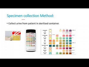 Leukocyte Esterase test
