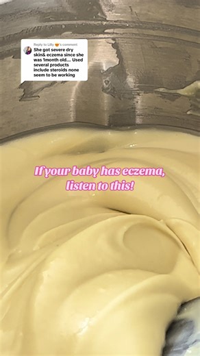 Heal Your Baby's Eczema with Natural Skincare Remedies